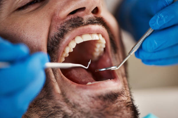 Oral Surgery in Escatawpa, MS