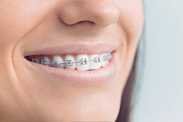 Best Invisalign and Clear Aligners  in Escatawpa, MS